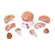 Hjerne med arterier