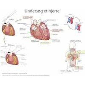 Dissekeringsduk hjerte