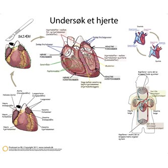 Dissekeringsduk hjerte